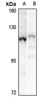 CHSY3 Rabbit Polyclonal Antibody