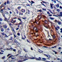 CHSY3 Rabbit Polyclonal Antibody