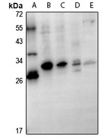 GSTT1 Rabbit Polyclonal Antibody