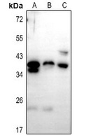 PTGR1 Antibody