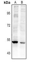 RASGEF1A Rabbit Polyclonal Antibody