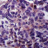 RASGEF1A Rabbit Polyclonal Antibody