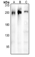 ARHGEF11 Rabbit Polyclonal Antibody