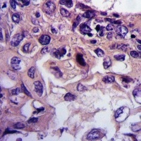 ARHGEF11 Rabbit Polyclonal Antibody