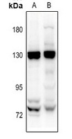 EMR1 Rabbit Polyclonal Antibody