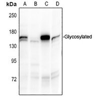 EMR1 Rabbit Polyclonal Antibody