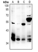 MCH Receptor 1 Antibody