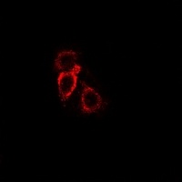 MCH Receptor 1 Antibody