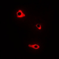 NMBR Rabbit Polyclonal Antibody