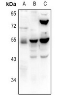 TRHR Rabbit Polyclonal Antibody