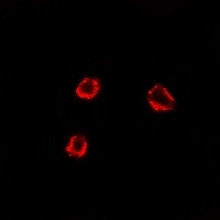 TRHR Rabbit Polyclonal Antibody