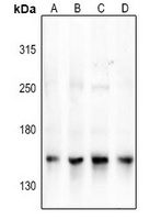 NCOA3 Rabbit Polyclonal Antibody