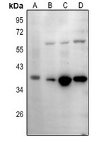 IgA1/2 Rabbit Polyclonal Antibody