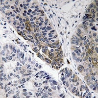 IgA1/2 Rabbit Polyclonal Antibody