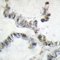 HMGXB3 Rabbit Polyclonal Antibody