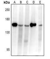 APAF-1 Rabbit Polyclonal Antibody