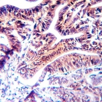 APAF-1 Rabbit Polyclonal Antibody