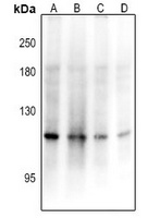 ADAMTS17 Rabbit Polyclonal Antibody