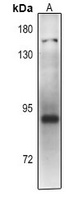 PLA2G4D Rabbit Polyclonal Antibody