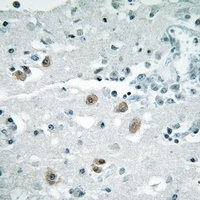 PLA2G4D Rabbit Polyclonal Antibody