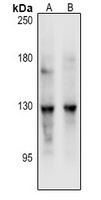 REXO1 Rabbit Polyclonal Antibody
