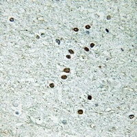 REXO1 Rabbit Polyclonal Antibody
