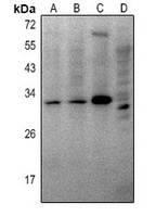 THOC4 Rabbit Polyclonal Antibody