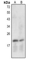 Caspase 7 p20 Antibody