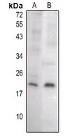 Caspase 8 p18 Rabbit Polyclonal Antibody