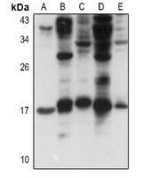 FGF1 Antibody