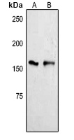 YTHDC2 Rabbit Polyclonal Antibody