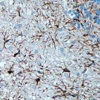 GFAP Antibody