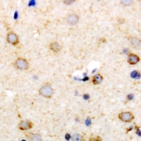 IL-22 Antibody