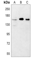 YTHDC2 Rabbit Polyclonal Antibody