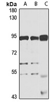 METTL13 Rabbit Polyclonal Antibody