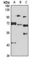 RBM14 Rabbit Polyclonal Antibody