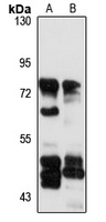 ACOX2 Rabbit Polyclonal Antibody