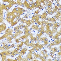 ACOX2 Rabbit Polyclonal Antibody