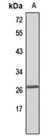 ACRV1 Rabbit Polyclonal Antibody