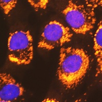 ACSL1 Rabbit Polyclonal Antibody