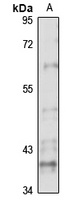 ACVR2B Rabbit Polyclonal Antibody