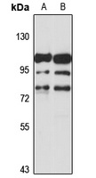 ADAM11 Rabbit Polyclonal Antibody