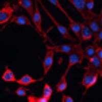 ADAM11 Rabbit Polyclonal Antibody