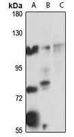 ADAMTSL4 Rabbit Polyclonal Antibody