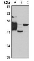 Centaurin-alpha-1 Rabbit Polyclonal Antibody