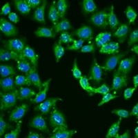 Centaurin-alpha-1 Rabbit Polyclonal Antibody