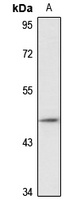Centaurin-alpha-2 Rabbit Polyclonal Antibody