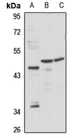 AdipoR2 Rabbit Polyclonal Antibody
