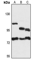 AK7 Rabbit Polyclonal Antibody
