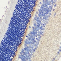 ANO2 Rabbit Polyclonal Antibody